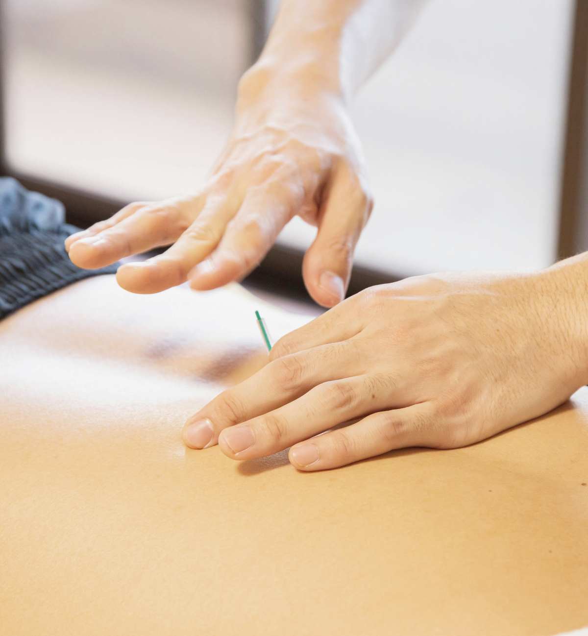 Curso de Acupuntura